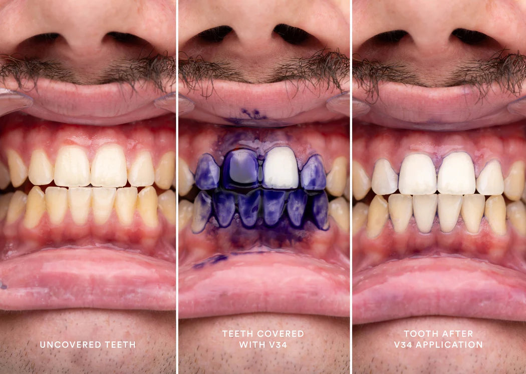 Hismile - Teeth Brightening Serum V34 (Original)